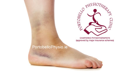 Ankle Pain - Portobello Physiotherapy