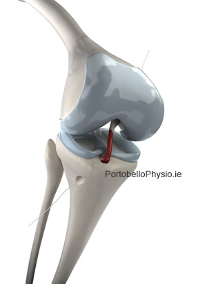 Anterior Cruciate Ligament (ACL) Injury